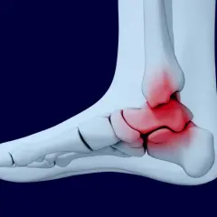 Anatomia stawu skokowego z zaznaczonym bólem. Może to być podstawa do ubiegania się o odszkodowanie za uraz, kod choroby s90.