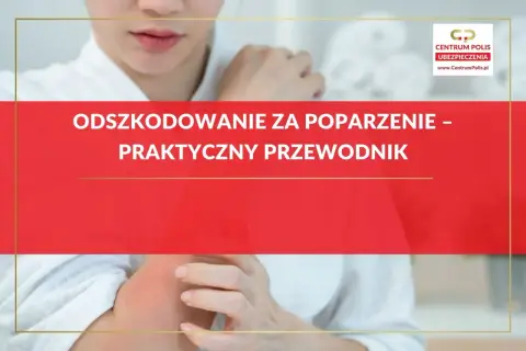 Odszkodowanie za oparzenie – praktyczny przewodnik. Kobieta z zaczerwienionym ramieniem, dotyka bolącego miejsca.