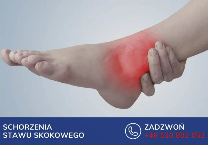 Ból kostki z zaczerwienieniem sugeruje nieleczone złamanie kostki. Skontaktuj się z nami, aby uzyskać pomoc.