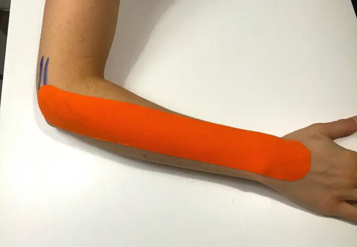 Pomarańczowy plaster kinezjotaping na przedramieniu, wsparcie przy łokciu tenisisty. PZU odszkodowanie za łokieć tenisisty.
