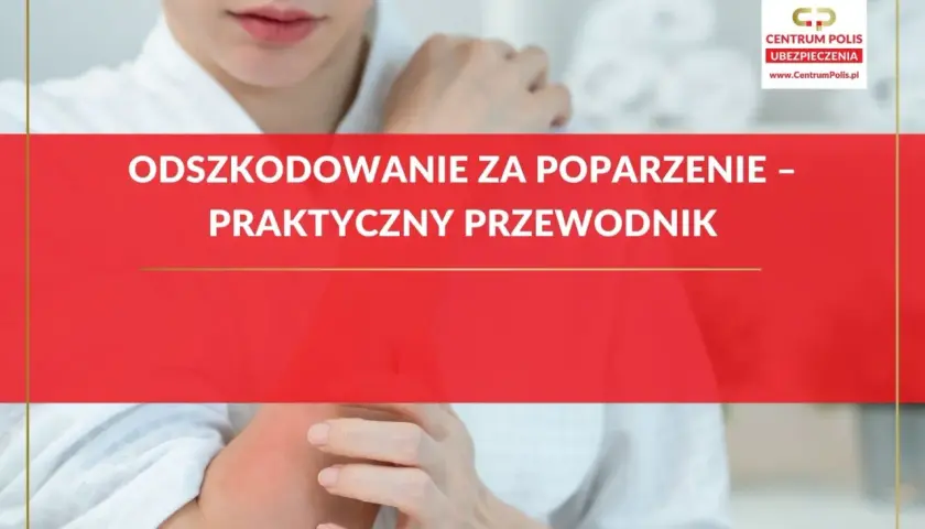 Odszkodowanie za oparzenie – praktyczny przewodnik. Kobieta z zaczerwienionym ramieniem, dotyka bolącego miejsca.