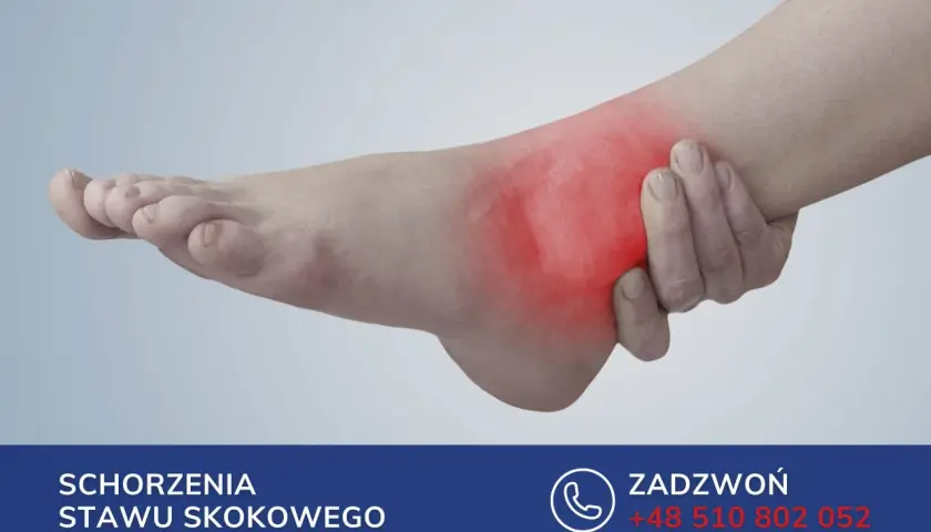 Ból kostki z zaczerwienieniem sugeruje nieleczone złamanie kostki. Skontaktuj się z nami, aby uzyskać pomoc.