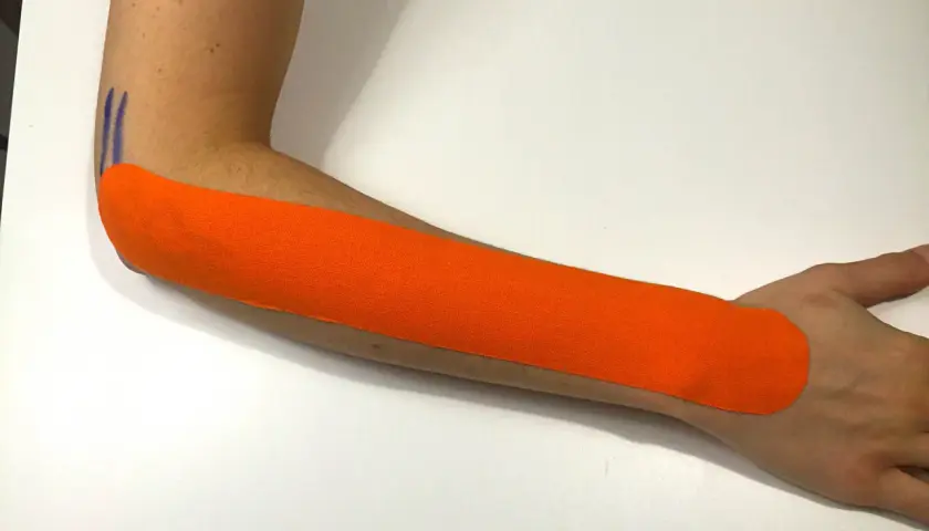 Pomarańczowy plaster kinezjotaping na przedramieniu, wsparcie przy łokciu tenisisty. PZU odszkodowanie za łokieć tenisisty.
