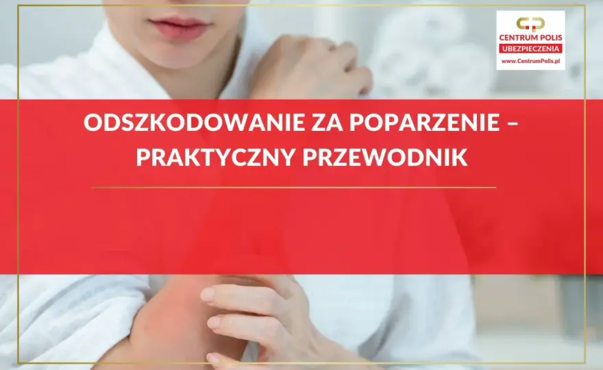 Odszkodowanie za oparzenie - Jak uzyskać pełną kwotę?