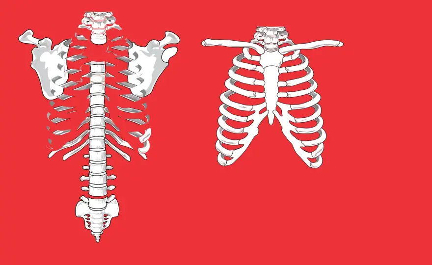 Odszkodowanie za złamane żebro z PZU - Ile dostaniesz?