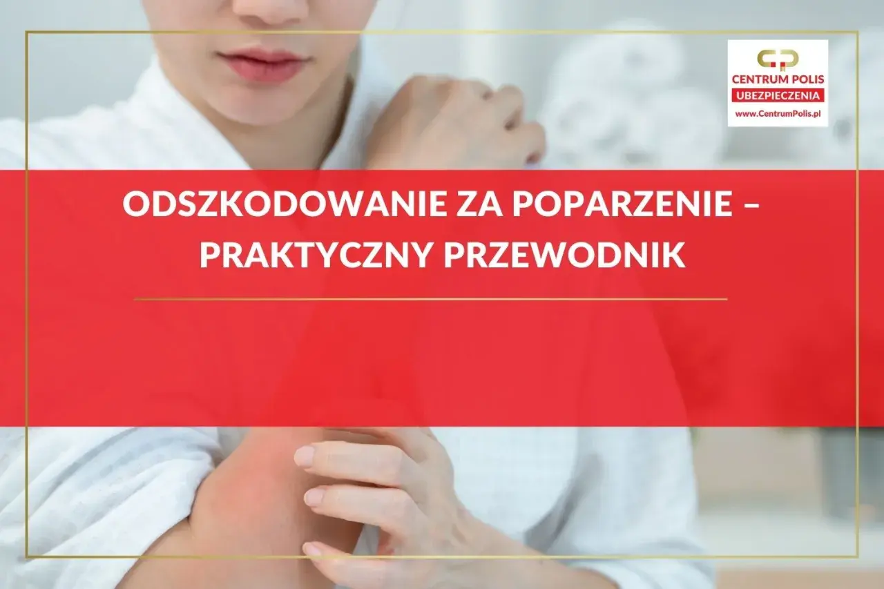 Odszkodowanie za oparzenie – praktyczny przewodnik. Kobieta z zaczerwienionym ramieniem, dotyka bolącego miejsca.