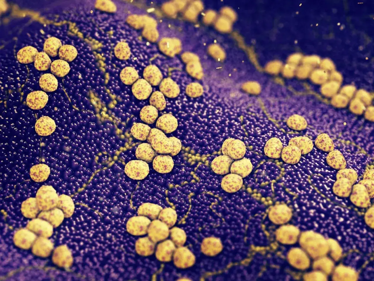 Groniaste skupiska bakterii, przypominające ziarna, unoszą się na fioletowym tle. Czy to groźny MRSA?